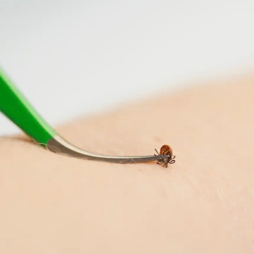 TickCheck Premium Tick
Remover Kit